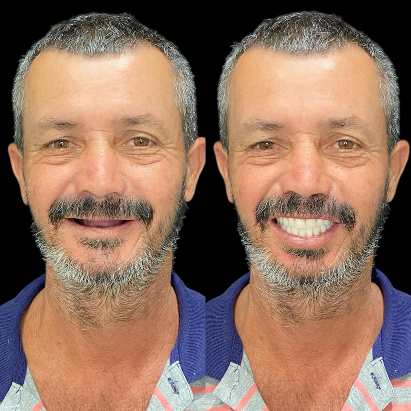 Caso real de protocolo fixo — antes e depois